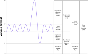A black and white graph of a sound wave
