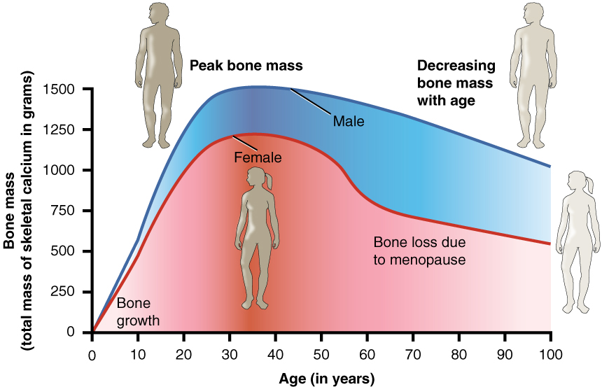 Graph of bone mass, y axis, versus age on x axis. Bone mass peaks at age 30 and then decreases.