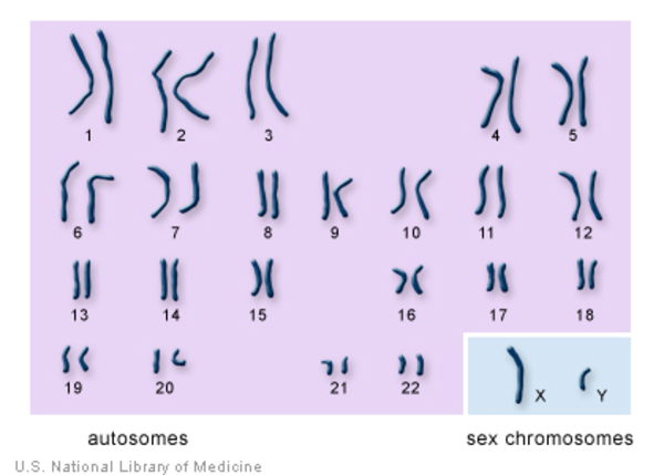 A normal male karyotype with 22 autosomes, one X chromosome, and one Y chromosome.