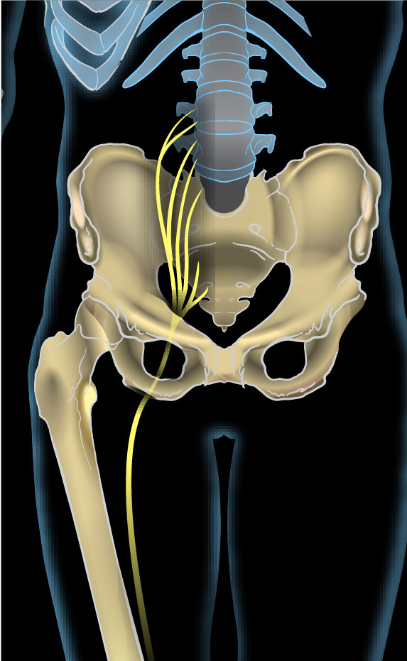 illustration of a pelvic x-ray showing the sciatic nerve