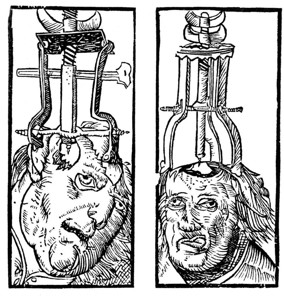 2 engravings of an apparatus drilling into patients' skulls.