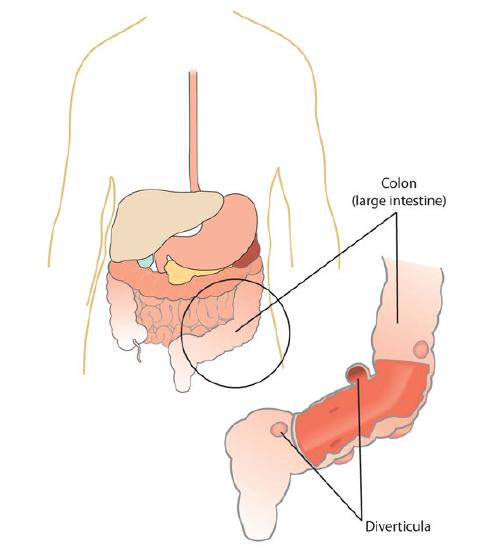 An illustration of the organs in the human torso, and a close-up of the colon.