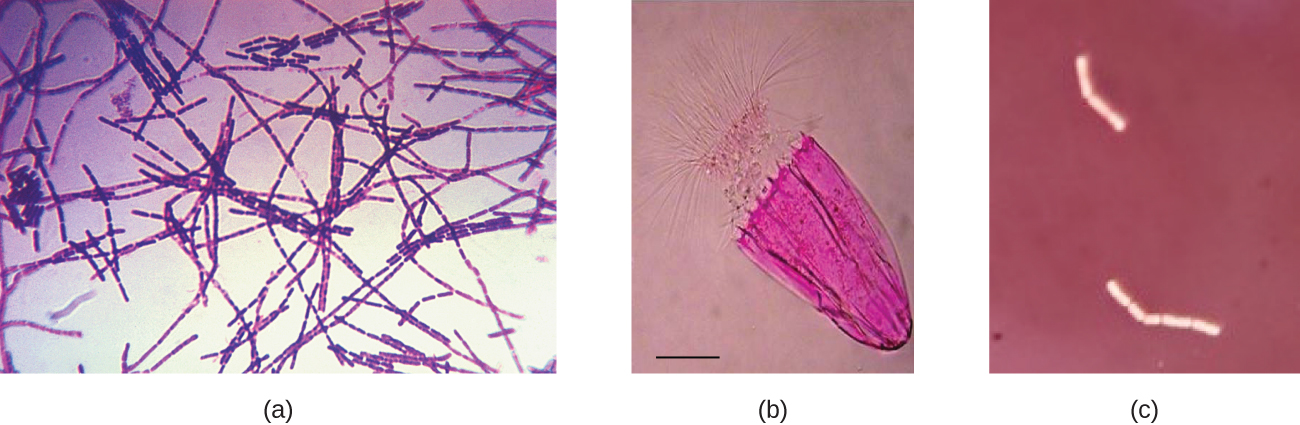 Three micrographs of Bacillus anthracis cells