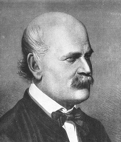 gnaz Semmelweis