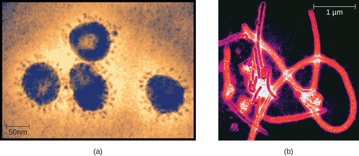 microscopic shots of the Coronavirus family, and a microscopic shot of Ebolavirus, a member of the Filovirus