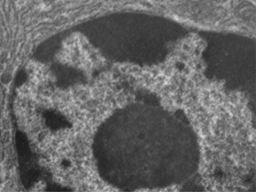 A micrograph of a nucleus