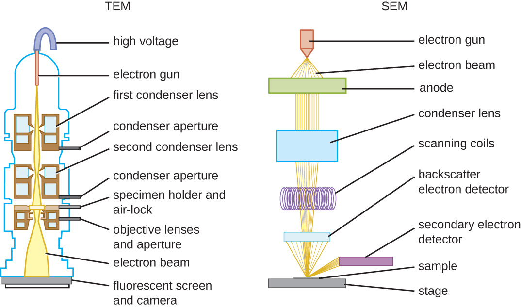 An illustration of a T.E.M. diagram