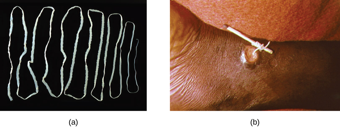An image of the beef tapeworm Taenia saginata, and an image of an adult guinea worm, Dracunculus medinensis