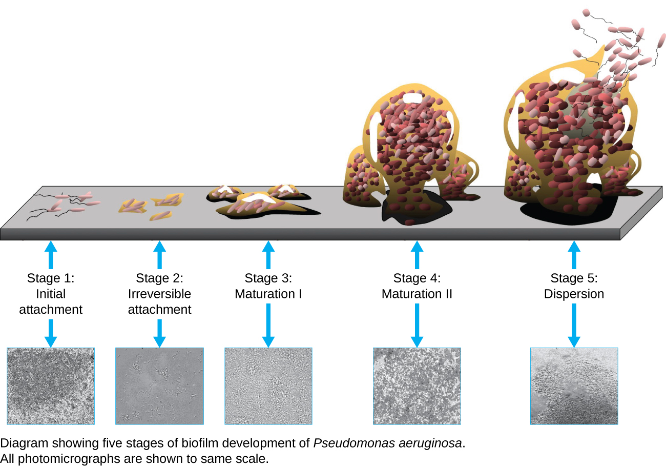 The stages of biofilm