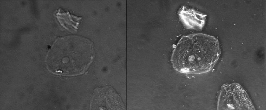 Two Micrographs of a cell on a dark background.