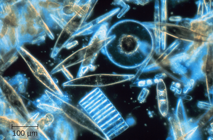 A microscopic view of assorted diatoms