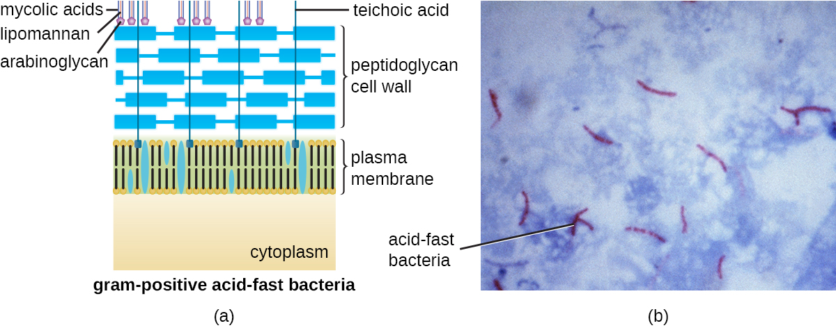 an illustration and a micrograph of gram-positive acid-fast bacteria