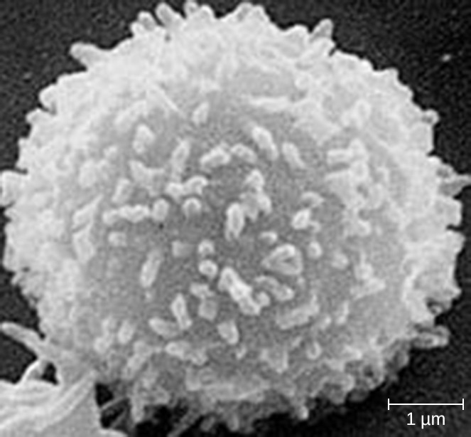 electron micrograph of a T lymphocyte