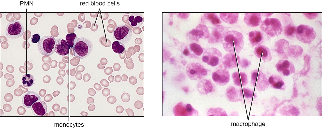 Monocytes are large cells with a large purple nucleus
