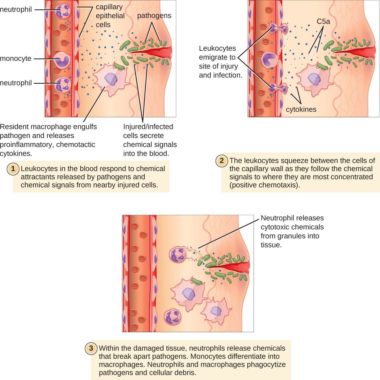 A diagram of wound infection with 3 steps