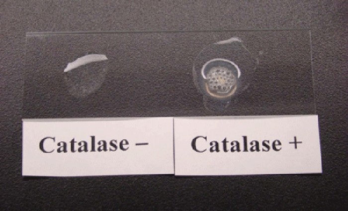 catalase test
