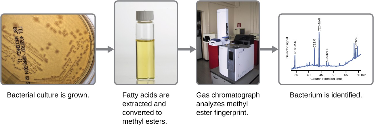steps in the fatty acis methyl ester (FAME) analysis