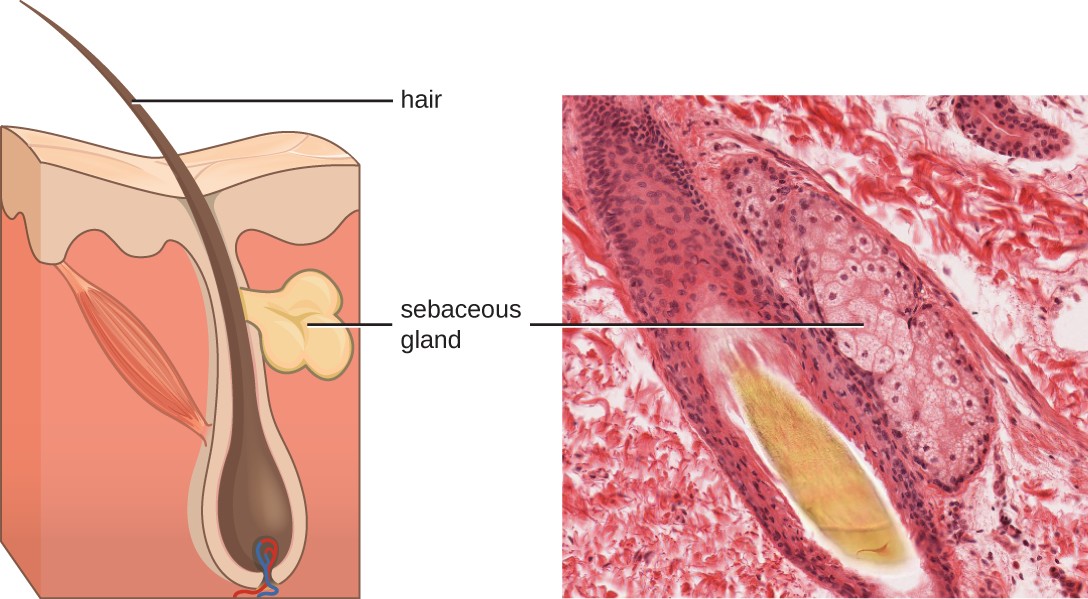 A micrograph and diagram both show a large hair follicle