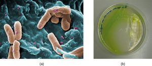 2 photos: (a) scanning election micrograph of Pseudomonas aeruginosa and (b) cetrimide agar