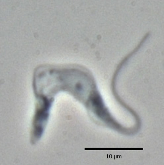 Micrograph shows T. brucei, which has a u-shaped cell body and a long tail.
