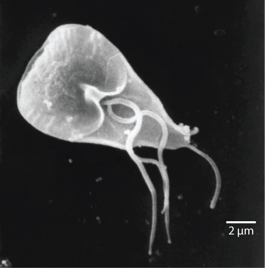 The micrograph shows Giardia, which is shaped like a corn kernel and about 12 to 15 microns in length. Three whip-like flagella protrude from the middle of the parasite, and a whip-like tail protrudes from the narrow back end.