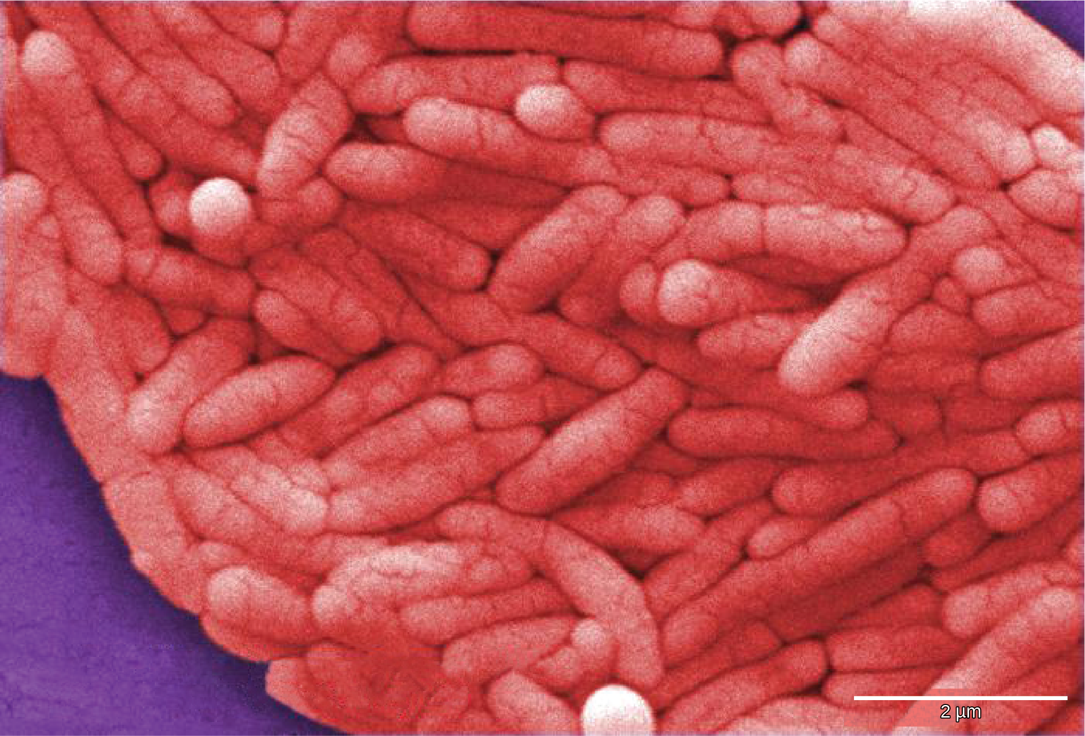 Micrograph shows pink rod-shaped bacteria.