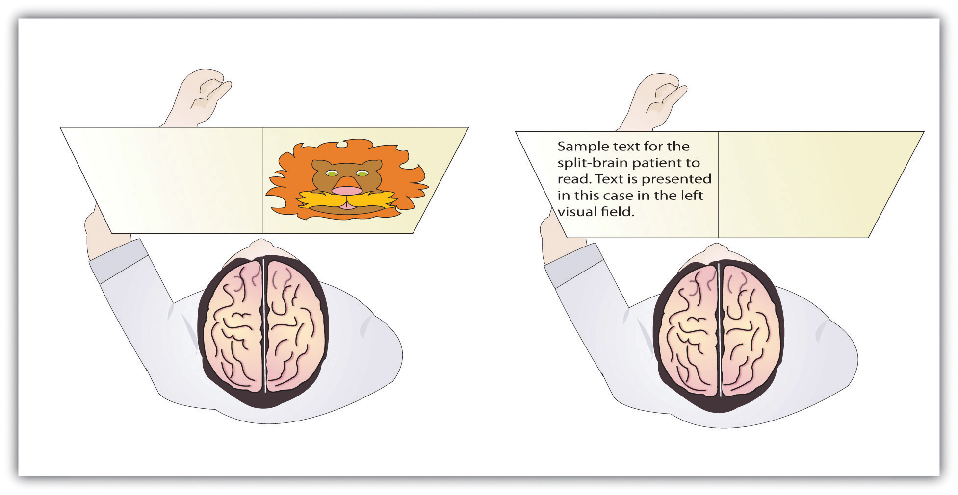 Visual and verbal processing in the split-brain patient