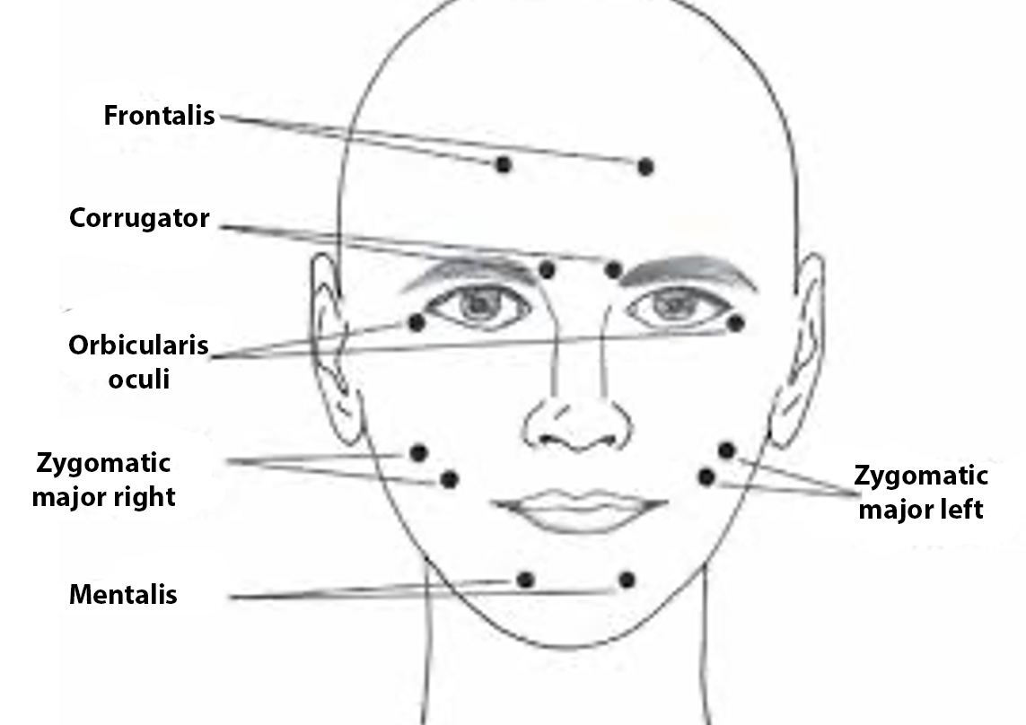 diagram depicting location of common facial muscles measures in facial EMG