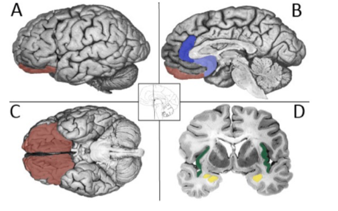 Four pictures of brain structure. Each picture has a different part of brain highlighted.