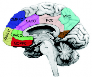 location of VMPFC in brain