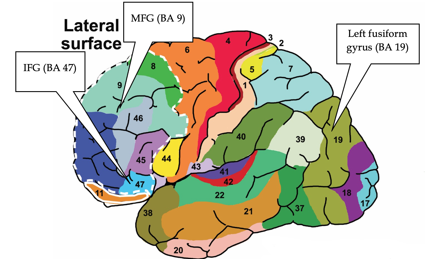 An illustration of the brain. There are 47 sections numbered on the brain. 3 of those sections are highlights and they are: IFG (BA 47), MFG (BA 9), and Left fusiform gyrus (BA 19).