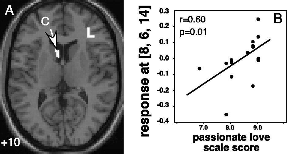 A Neuroimage of a brain that has "C", and "L" as labels on it. To the right of the neuroimage is a graph with several points plotted, and a median line graphed through the points.