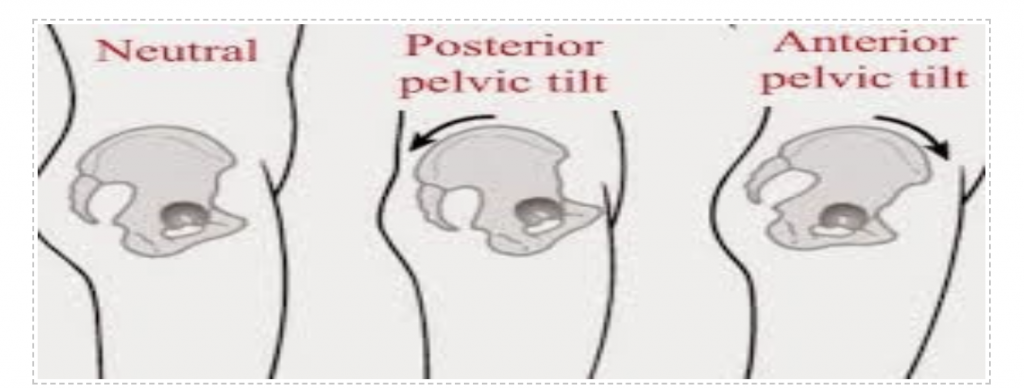 Posterior Pelvic Tilt